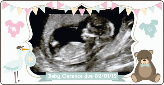12 week scan