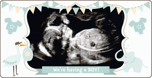 20_weeks_scan