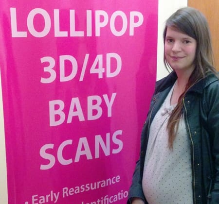 lollipop_scan_day