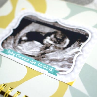 5 things you might do differently in a second pregnancy