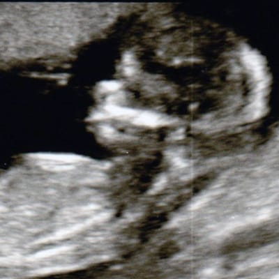Not sure where to give birth? It’s your choice…
