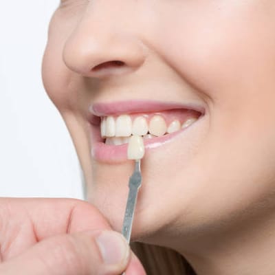 5 Reasons To Look Into Getting Porcelain Veneers