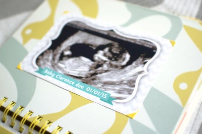 5 things you might do differently in a second pregnancy