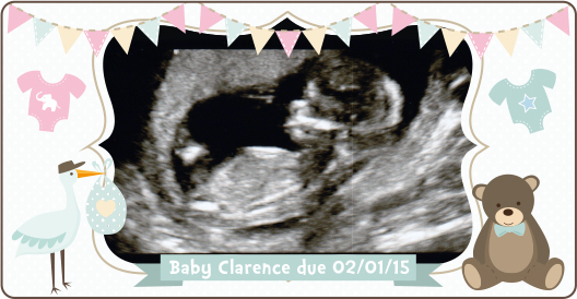 12 week scan
