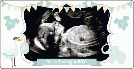 20_weeks_scan