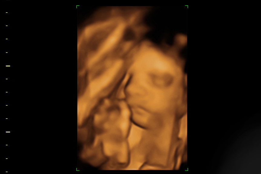 1_3D_Baby